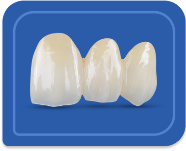 BruxZir Esthetic Bridge