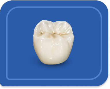 BruxZir Full Strength Crown