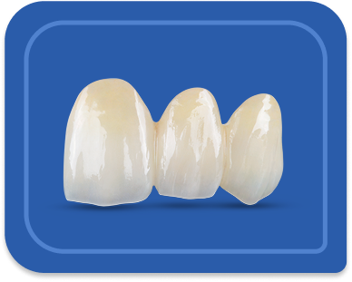 BruxZir veneers