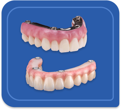 Implant Denture- desktop