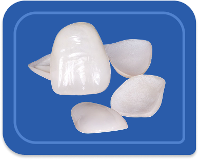 IPS e.max Veneers