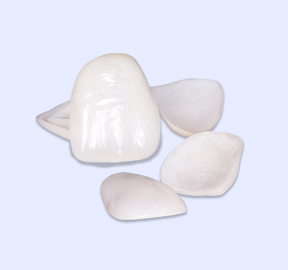 Veneers
